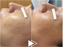 リシェス(Richesse)/徹底シミ改善★初回¥11990