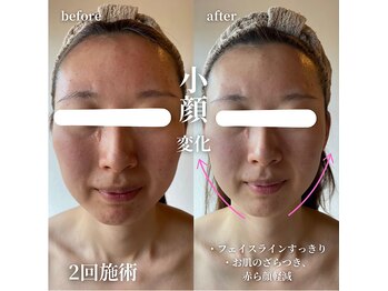 エステティックサロン ドゥネール