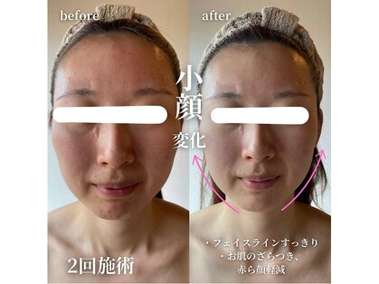 エステティックサロン ドゥネールの写真