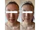 エステティックサロン ドゥネールの写真