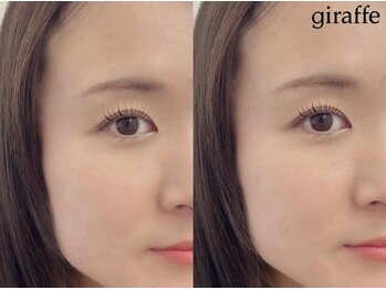 ジラフ(giraffe)/【ラッシュリフト】立ち上げ