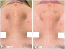 サロンドフェイス(Salon de Faith)/【フォト+ハーブ】1回施術♪