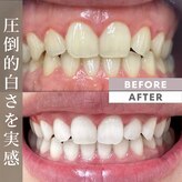 ホワイトニングショップ 香川丸亀店