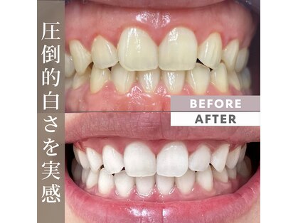 ホワイトニングショップ 香川丸亀店の写真