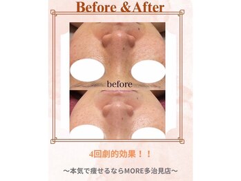 モア 多治見店(MORE)/お客様ビフォーアフター♪