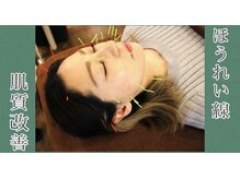 レゴリス/電気美容鍼