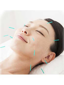 りゅうさん鍼灸整体院の写真/滞った流れを整え、血流を促進。むくみ・たるみを改善し、フェイスラインがすっきりした小顔へ導く美容鍼灸