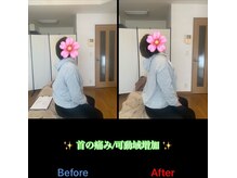 ヴィバランス(Vebalance)/たった一度の施術