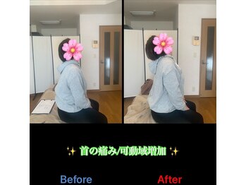 ヴィバランス(Vebalance)/たった一度の施術