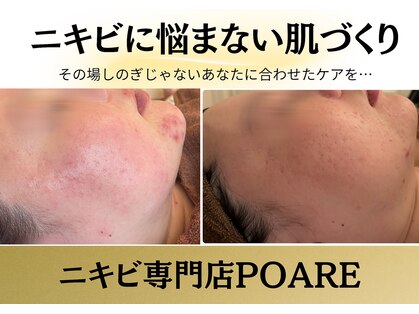 ポアレ(POARE)の写真
