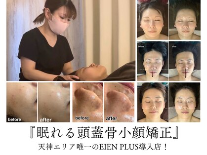 アベリア リュウ(Aberia Lieu)の写真