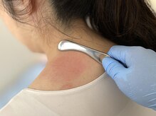 カンギトネリ(咸宜toneri)/肩凝り筋膜リリース！