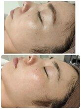 ビエストラ(Biestora)/