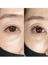 メイズ(May's)/LEDフラットラッシュ100