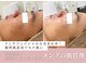 ミュー 名東一社店(mieux)の写真