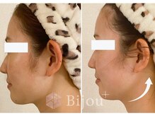 ビジュープラス 神栖店(Bijou+)の雰囲気（お顔の歪み・左右差・フェイスラインが気になる方に◎）