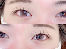 ソア(soa.)/パリエク100本(Haruka施術)