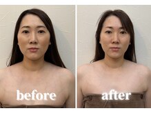 グレースフィオーレ モラージュ柏店(gracefiore)/【ヘッドスパ】ビフォーアフター