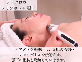 スターティス(STATICE)/STATICE~レモンボトル顎下~