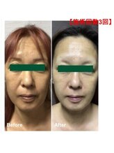 ドール(doll)/本格美肌管理専門店だからこそ