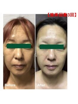 ドール(doll)/本格美肌管理専門店だからこそ