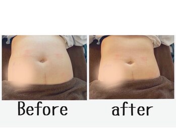 リズビー(Lisbe)/薬院/リンパ/痩身