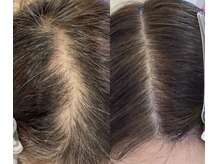 クレールドルナ(Clair de Lune)の雰囲気（本気の頭皮改善ならプロセルセラピーズ一択！）