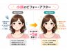 No,3☆小顔・むくみケア＋首肩こり調整の小顔整体〈60分/通常8,000→6,000〉