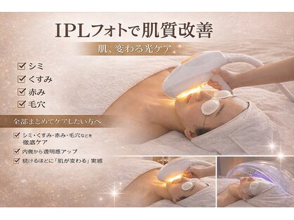 ロイズ(ROYCE)の写真