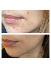 ヨリ(yori)/ホームケアandサロンケア1年半