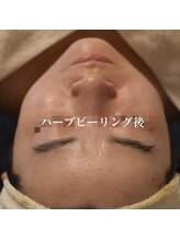 ココルーネ(COCORUNE)/シルク肌ハーブピーリング