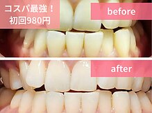 ボディアーキ 松山店(BODY ARCHI)/