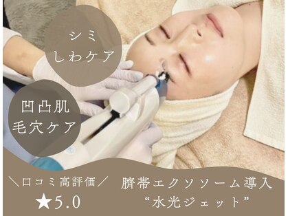 シェノン(Chainon)の写真