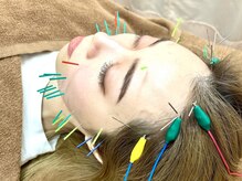 伊藤接骨院の雰囲気（人気の美容鍼もご体感ください◎【肩こり/腰痛/鍼灸/美容鍼】）