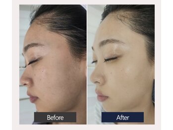 エスビーエス オキナワ(SBS OKINAWA)/第5世代ダクトピールモニター様