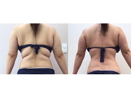 ニカ(NIKA)の写真