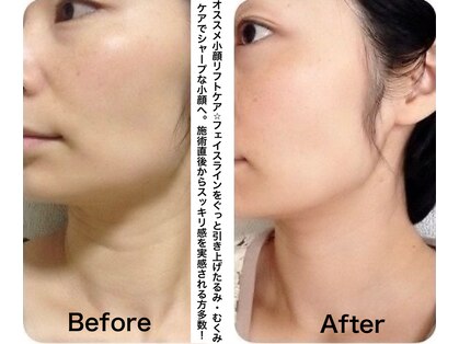 ドリームバスト 南森町(Dream Bust)の写真