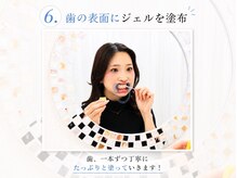 ホワイトニングサロン ホワイト 前橋店(WHITE)/6.歯の表面にジェルを塗布
