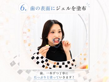 ホワイトニングサロン ホワイト 前橋店(WHITE)/6.歯の表面にジェルを塗布