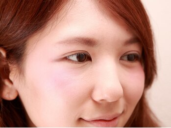 ラックス 北千住店(LAX presents by FereBright)/【Before写真】