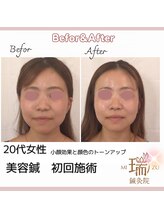 瑞 鍼灸院/ビフォーアフター