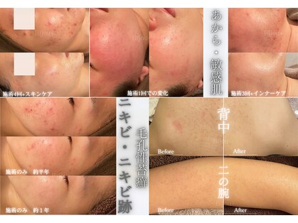 ビジュープラス 水戸店(Bijou+)の写真