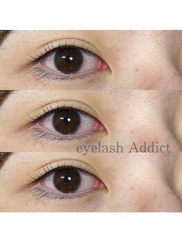 アディクト(Addict)/