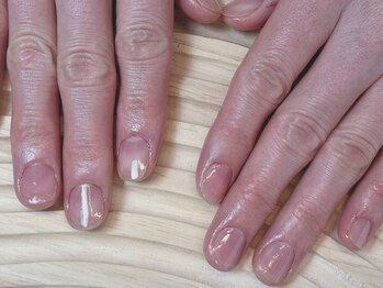 フロム(...froM)の写真/自爪から健康的で美しい指先へ…乾燥・二枚爪、巻き爪等のお悩みに寄り添ってサポートしていきます。