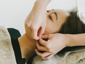 アキュネ 福岡薬院店(acune)/福岡/薬院/美容鍼/美肌