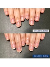 ブラン(blanc)/15.自爪育成