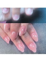 キューティー 錦糸町店(Cutee)/深爪スカルプ