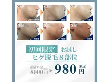 ネクスト 伊勢店(NEXT)の雰囲気（大人気顔脱毛が全部位して　980円）