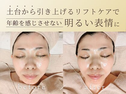 ココアールの写真