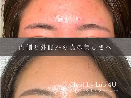 ヘルスラボフォーユー(Health Labo4U)の写真
